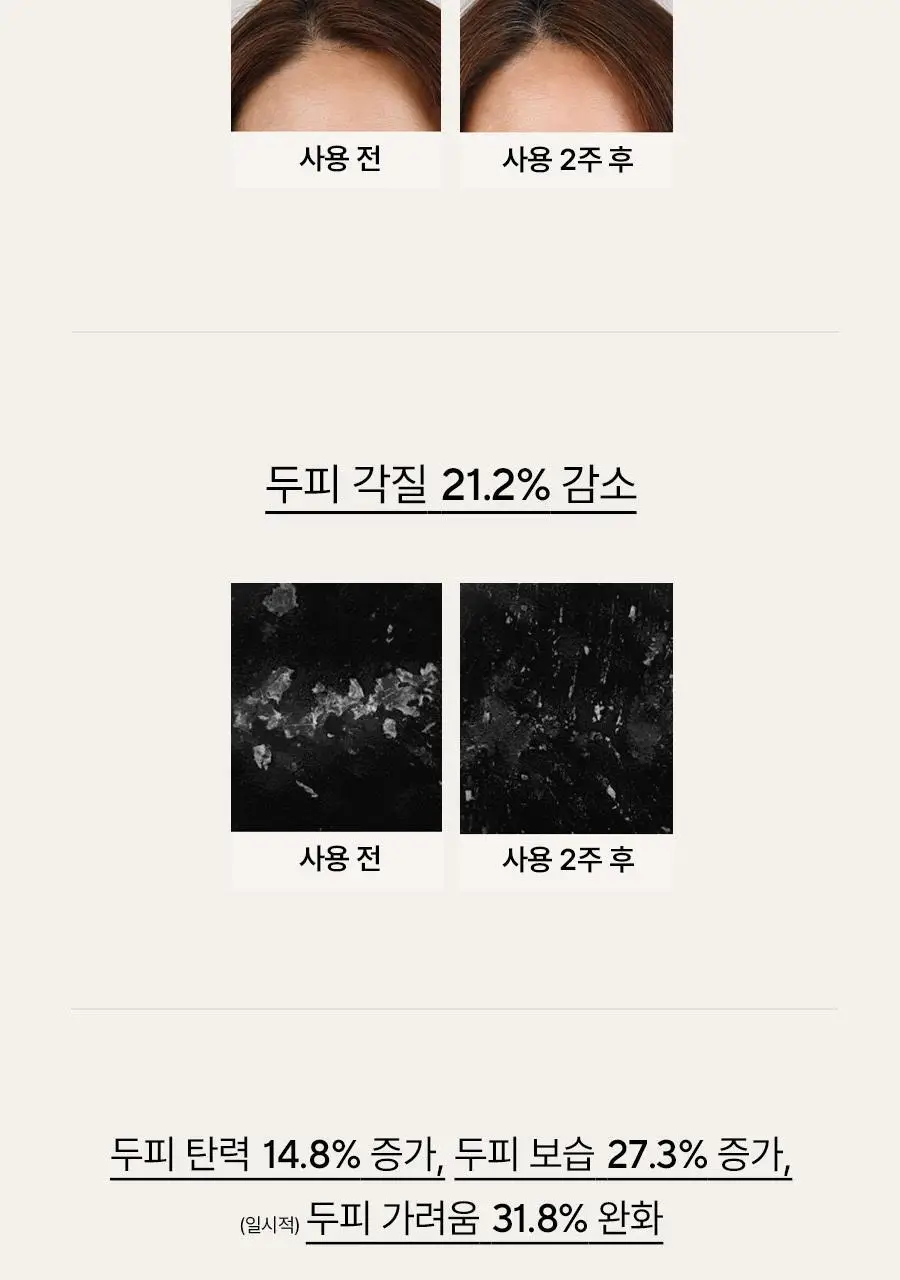 [탈모증상완화] 아로마티카 로즈마리 솔트 스크럽 샴푸 300g 기획(+로즈마리 컨디셔너 100ml) 상세페이지 9
